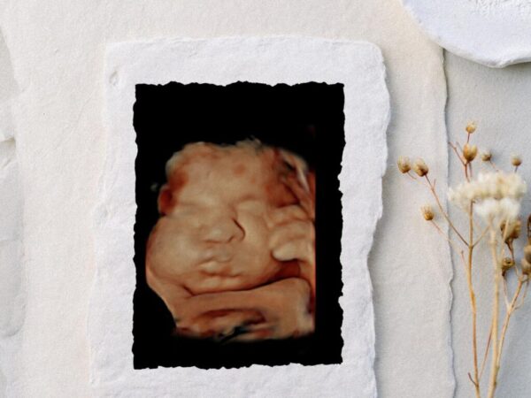 8k ultrasound imaging near me, Nashville private ultrasounds