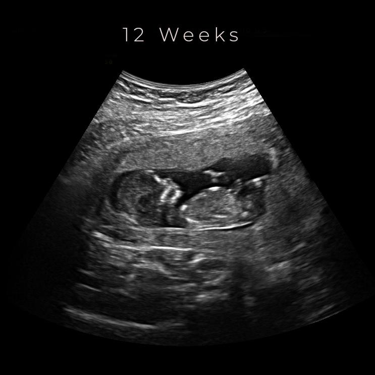 best 4d ultrasound nashville tn