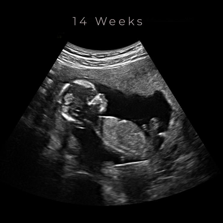 Ultrasound Experience