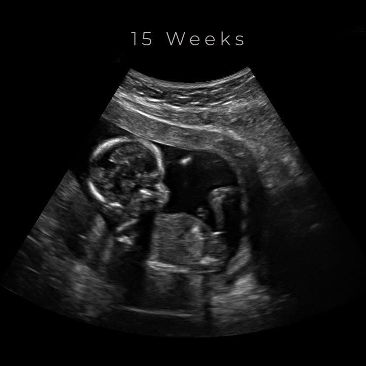 Ultrasound Experience