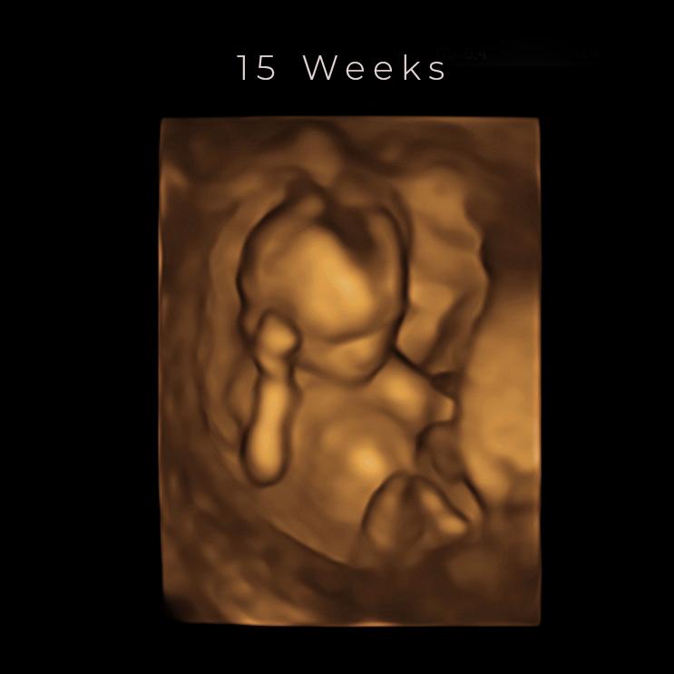 Ultrasound Experience