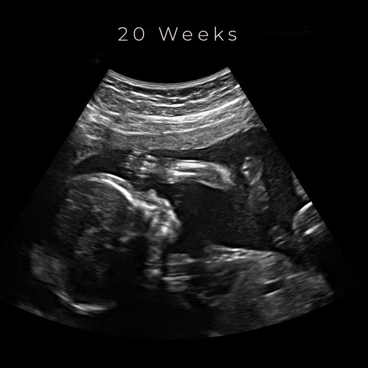 Ultrasound Experience