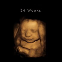 best 4d ultrasound nashville tn - 24 weeks