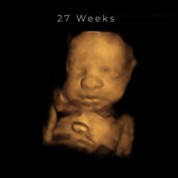 best 4d ultrasound nashville tn - 27 weeks