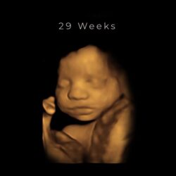 best 4d ultrasound nashville tn - 29 weeks