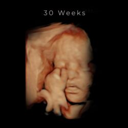 best 4d ultrasound nashville tn - 30 weeks
