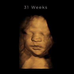 best 4d ultrasound nashville tn 31 weeks