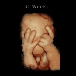 best 4d ultrasound nashville tn 31 weeks