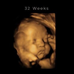 best 4d ultrasound nashville tn 32 weeks