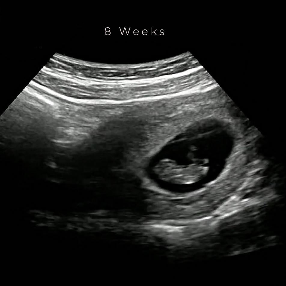 best 4d ultrasound nashville tn