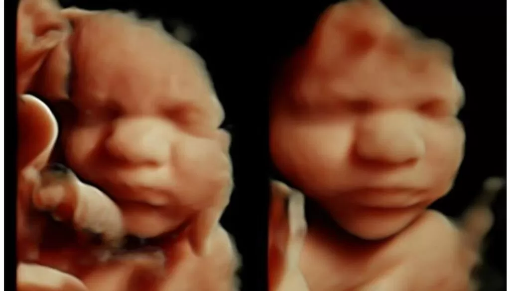 4d nashville ultrasound