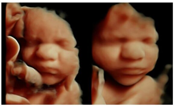 4d nashville ultrasound