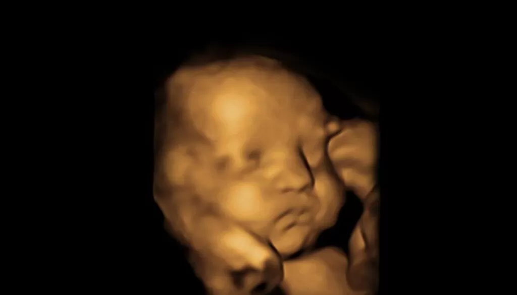 4D Ultrasound Nashville, private ultrasound Nashville, Ultrasound near me