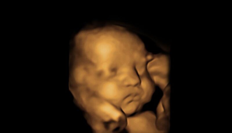 Nashville-4D-Ultrasound-Services 4D Ultrasound Nashville, private ultrasound Nashville, Ultrasound near me