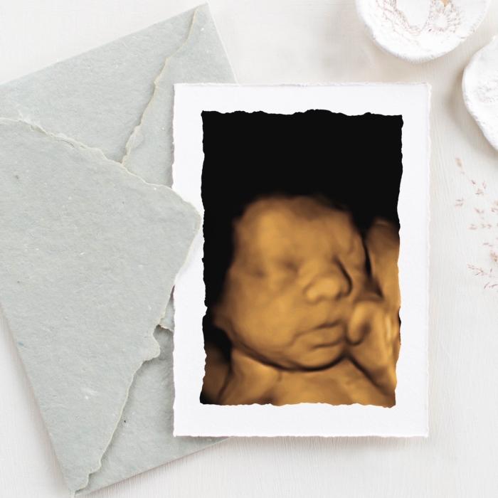 baby's 1st heartbeat nashville tn, private ultrasound nashville, 1st heartbeat ultrasound Nashville