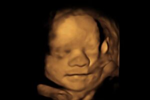 best-4d-ultrasound-nashville-tn-33 best-4d-ultrasound-nashville-tn 33 weeks