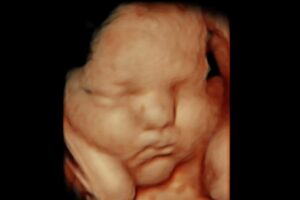 best-4d-ultrasound-nashville-tn-35 best-4d-ultrasound-nashville-tn 35 weeks