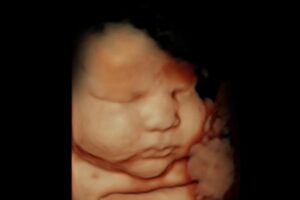 best-4d-ultrasound-nashville-tn-36 best-4d-ultrasound-nashville-tn - 36 weeks