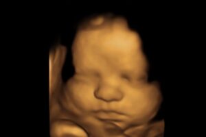 best-4d-ultrasound-nashville-tn-37 best-4d-ultrasound-nashville-tn 37 weeks