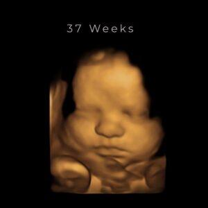 best-4d-ultrasound-nashville-tn 37 weeks