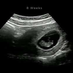 best-4d-ultrasound-nashville-tn 8 weeks
