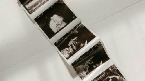 Schedule a private 2D 3D/4D HD ultrasound experience in Nashville