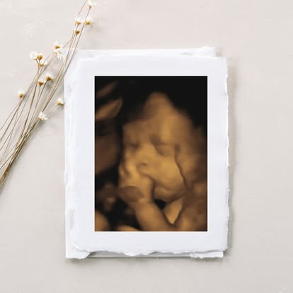 Nashville 3D 4D ultrasound Studio, gender ultrasound near me