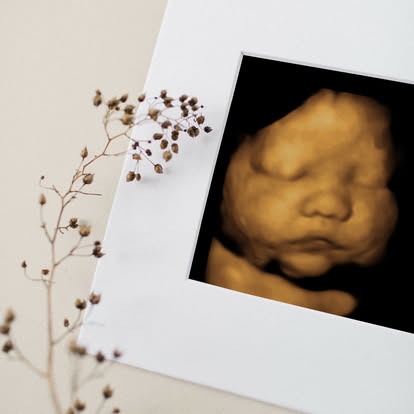 Nashville 2d 3d 4d 5d ultrasound