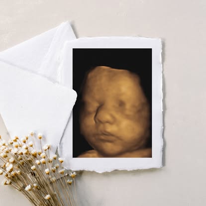 Nashville 2d 3d 4d 5d ultrasound
