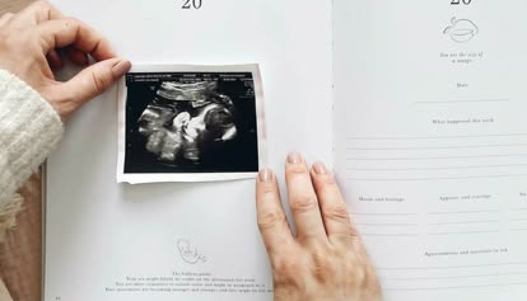 book elective ultrasound Nashvile, 4D Ultrasound Nashville, Private Ultrasound Nashville